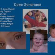 Chromosome Disorders